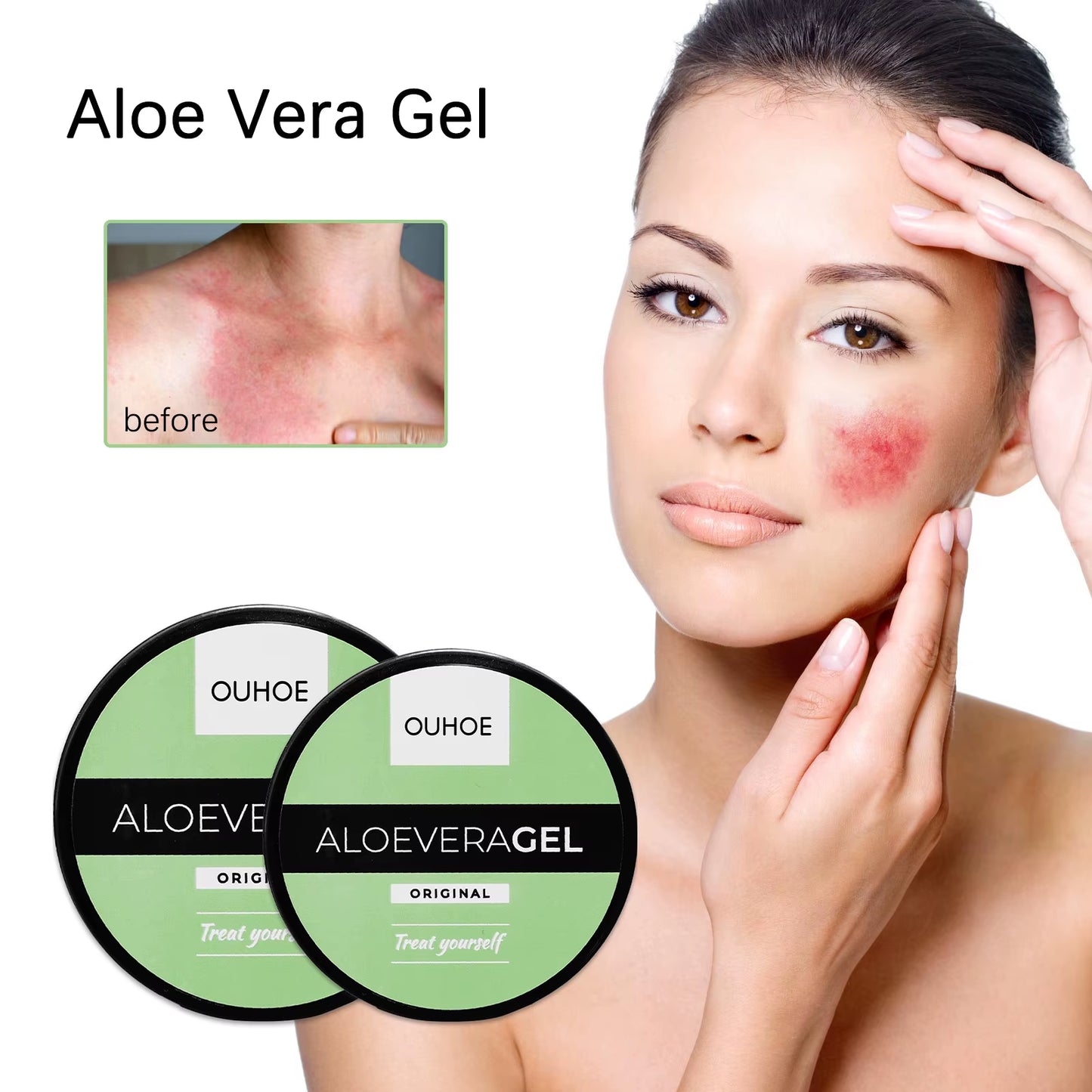 Aloe Vera Gel Nourishing Moisturizing Relieve Skin Redness after Sunburn Repair Skin Aloe Vera Gel Lotion Body and Face Skin Car